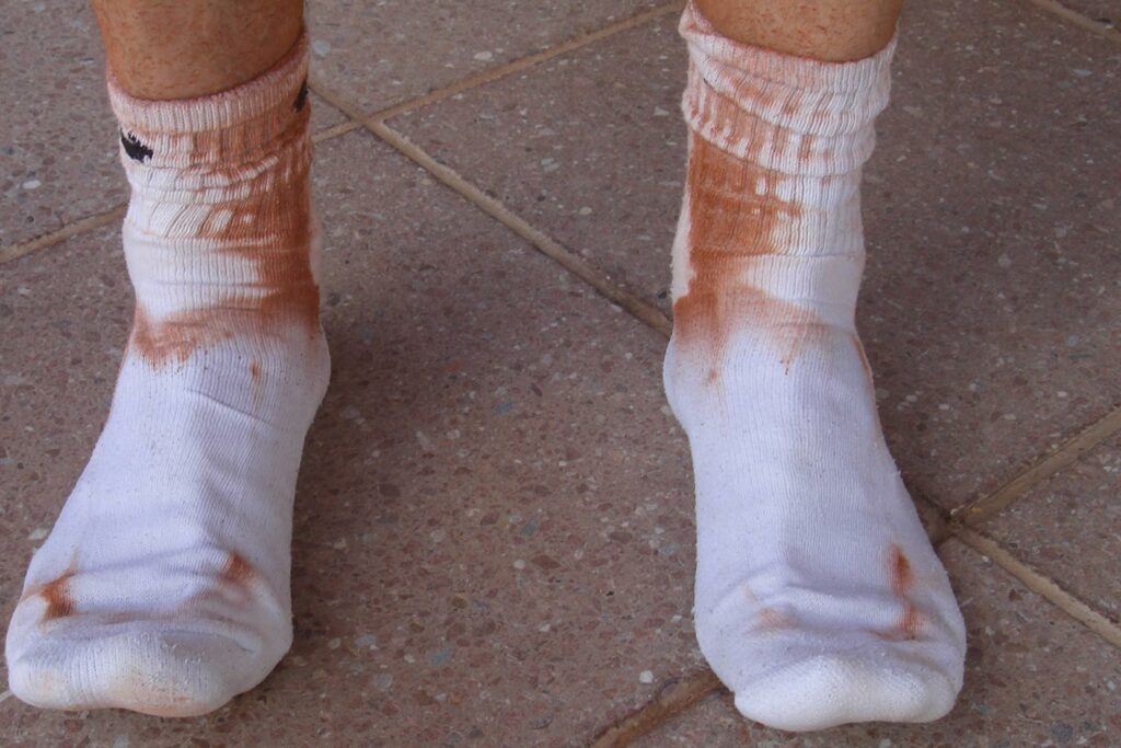 schmutzige Tennissocken